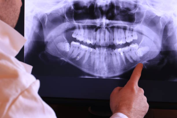 Best Broken or Chipped Tooth Repair in Marshall, IL