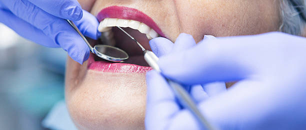 Best Emergency Treatment for Oral Infections in Marshall, IL